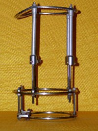 fixation apparatus for limb lengthening procedure