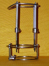 fixation apparatus